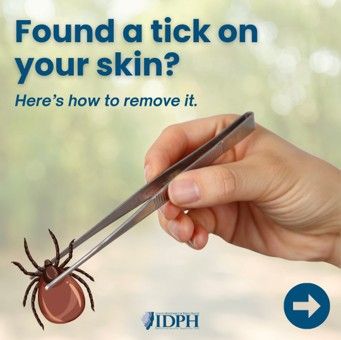 Tick remove 1