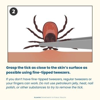 Tick Reove 4